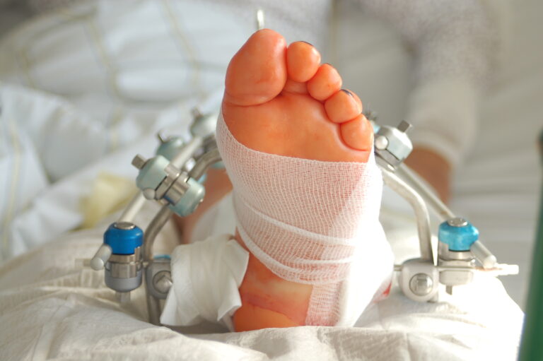 Reha nach OP / Unfall